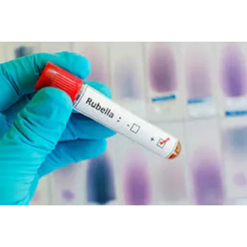 Rubella Vaccine